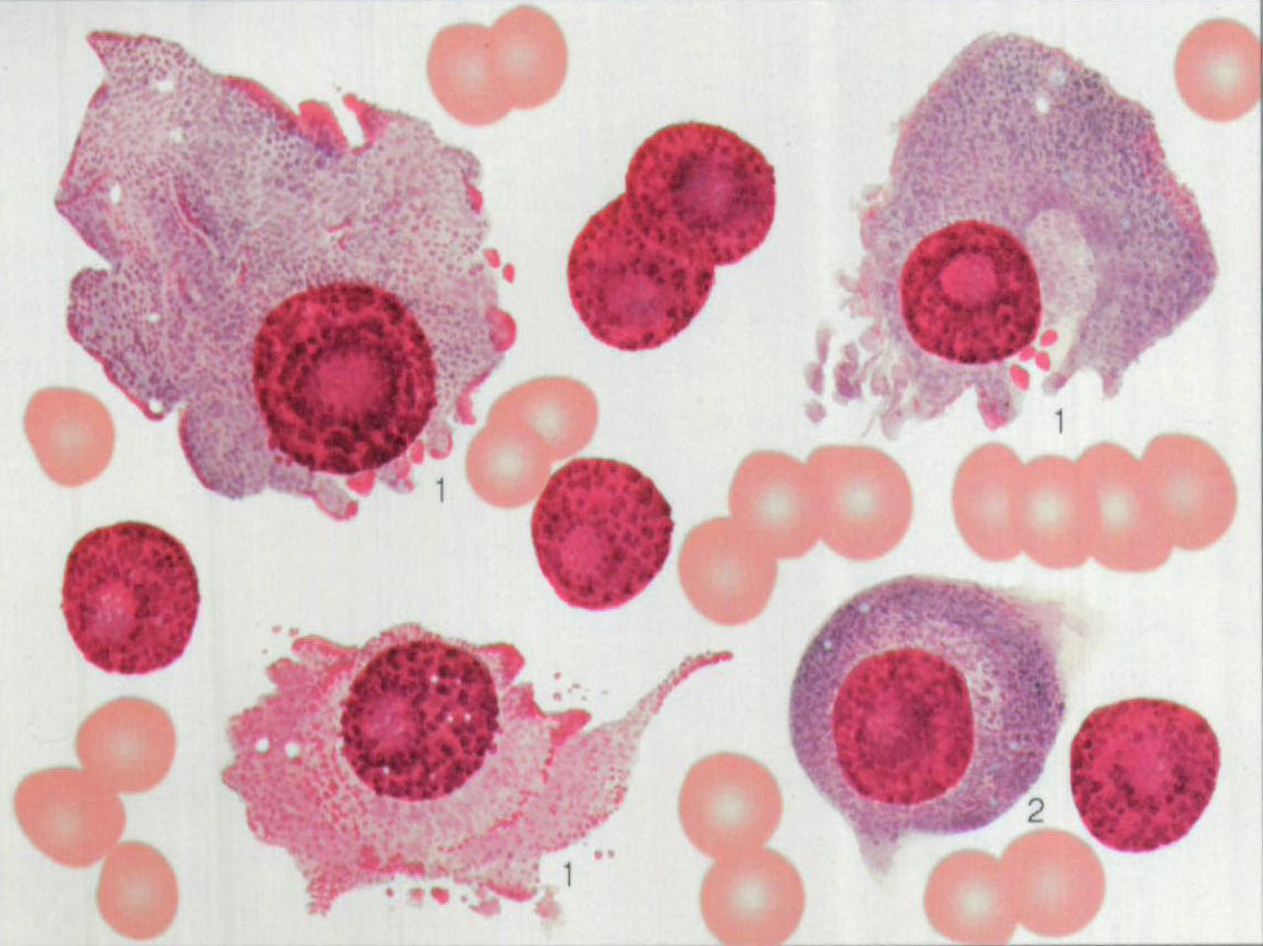 临床血液学检验技术实验报告（血细胞红蓝铅笔图，正常骨髓象观察记录） - 知乎